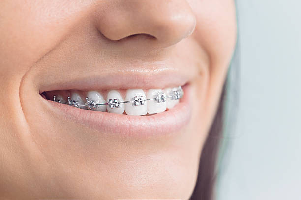 Laser Dentistry in Madison, IN
